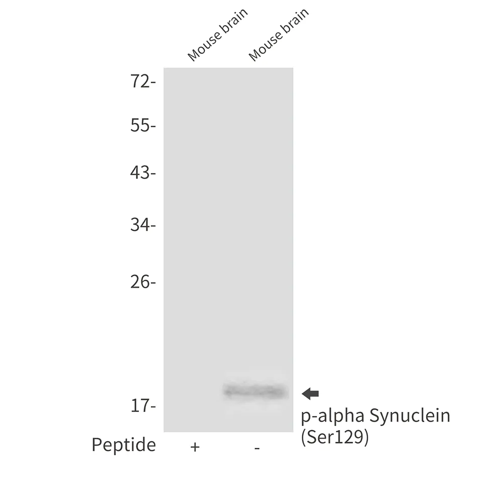 Western blot analysis of Phospho-alpha Synuclein (Ser129) in mouse brain lysates using Phospho-alpha Synuclein (Ser129) antibody.