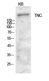 Western blot analysis of Tenascin in KB lysates using Tenascin antibody.