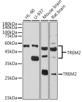 Western blot analysis of TREM2 in various cell lines lysates using TREM2 antibody.