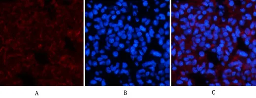 Immunofluorescence analysis of rat-lung tissue. 1,Amyloid-β Polyclonal Antibody(red) was diluted at 1:200(4°C,overnight). 2, Cy3 labled Secondary antibody was diluted at 1:300(room temperature, 50min).3, Picture B: DAPI(blue) 10min. Picture A:Target. Picture B: DAPI. Picture C: merge of A+B