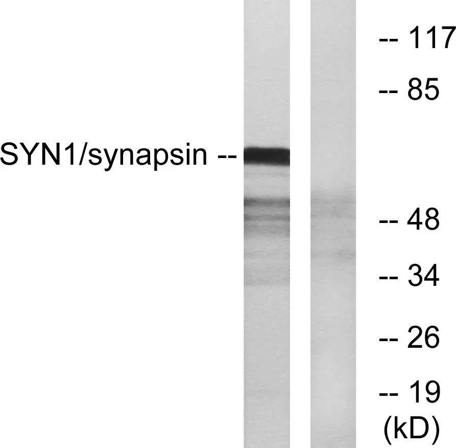 Western blot analysis of lysates from 293 cells, treated with PMA 200nM 30', using Synapsin Antibody. The lane on the right is blocked with the synthesized peptide.