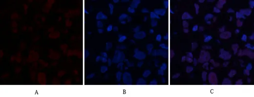 Immunofluorescence analysis of human-breast-cancer tissue. 1,ABCG2 Polyclonal Antibody(red) was diluted at 1:200(4°C,overnight). 2, Cy3 labled Secondary antibody was diluted at 1:300(room temperature, 50min).3, Picture B: DAPI(blue) 10min. Picture A:Target. Picture B: DAPI. Picture C: merge of A+B
