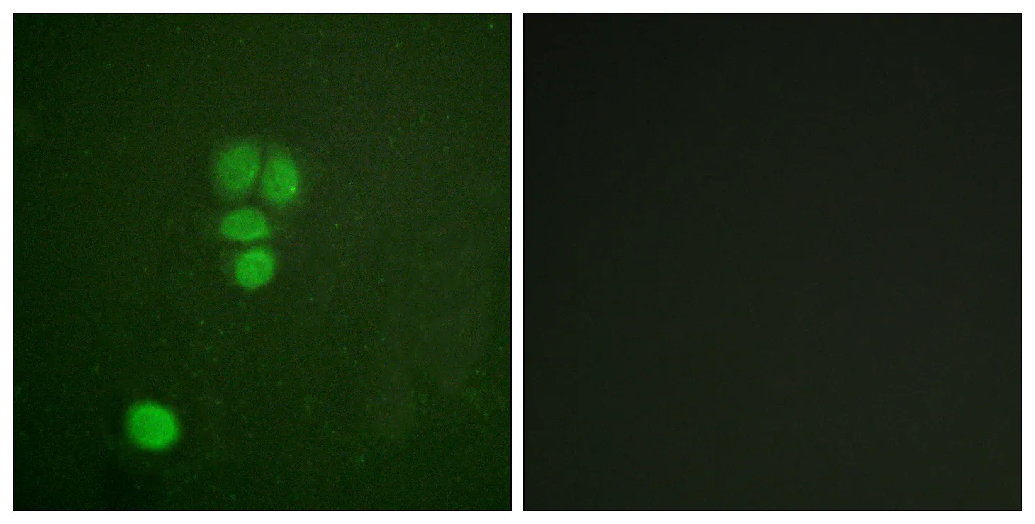 Immunofluorescence analysis of A549 cells, using SOX9 Antibody. The picture on the right is blocked with the synthesized peptide.