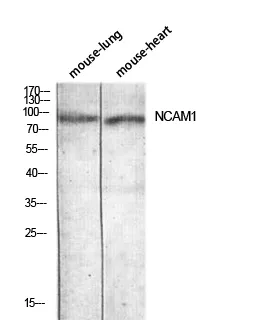 Western blot analysis of mouse-lung mouse-heart lysis using NCAM1 antibody. Antibody was diluted at 1:1000. Secondary antibody was diluted at 1:20000
