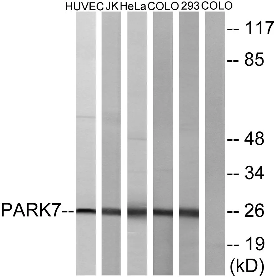 Western blot analysis of lysates from HUVEC, JurKat, HeLa, COLO205, and 293 cells, using PARK7 Antibody. The lane on the right is blocked with the synthesized peptide.