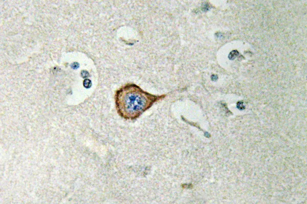 Immunohistochemistry analysis of CNPase antibody in paraffin-embedded human brain tissue.