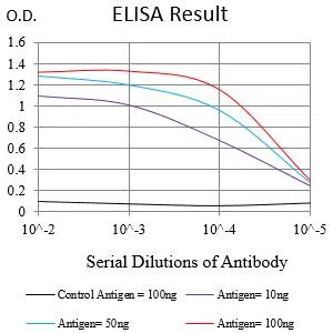 Black line: Control Antigen (100 ng);Purple line: Antigen (10ng); Blue line: Antigen (50 ng); Red line:Antigen (100 ng)