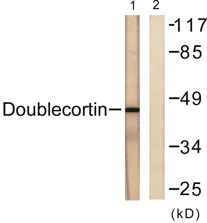 Western blot analysis of lysates from RAW264.7 cells, using Doublecortin Antibody. The lane on the right is blocked with the synthesized peptide.