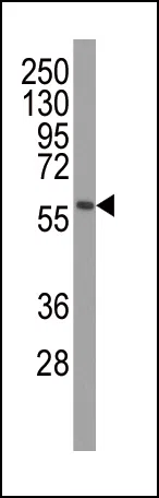 Western blot analysis of anti-PINK1 Monoclonal Antibody (PINK1 Mouse Monoclonal Antibody) in mouse brain tissue lysates. PINK1(arrow) was detected using the ascites Mab. (dilution 1:500)