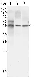 Western blot analysis using TUBB3 mouse mAb against HepG2 (1), A549 (2) and Hela (3) cell lysate.