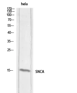 Western blot analysis of hela lysis using SNCA antibody.. Secondary antibody was diluted at 1:20000