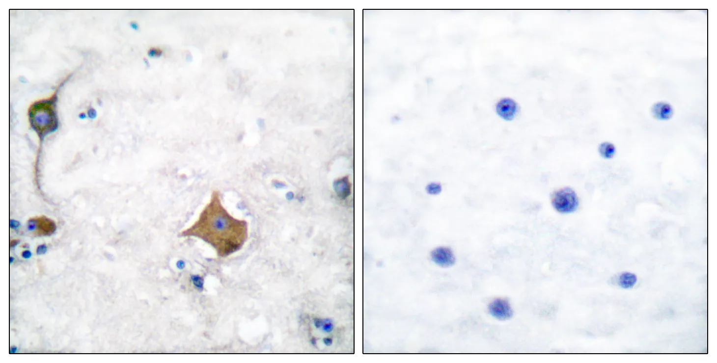 Immunohistochemistry analysis of paraffin-embedded human brain tissue, using Synaptophysin Antibody. The picture on the right is blocked with the synthesized peptide.