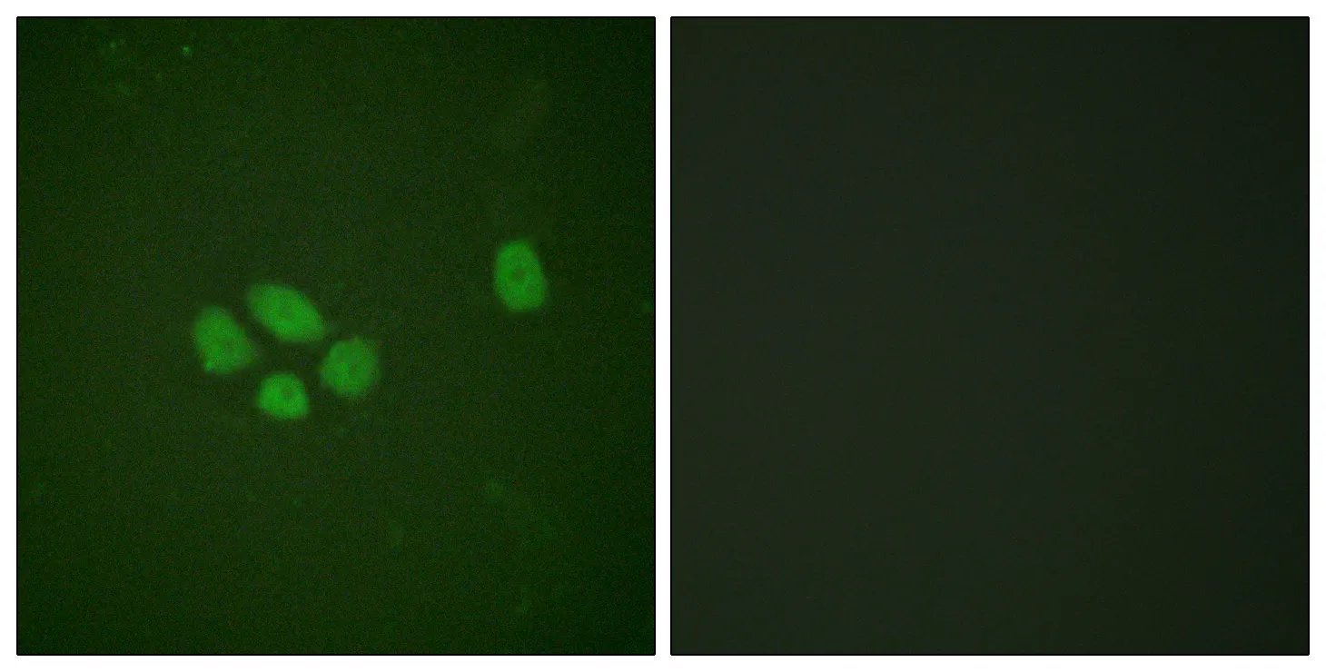 Immunofluorescence analysis of A549 cells, using SOX-9 (Phospho-Ser181) Antibody. The picture on the right is blocked with the phospho peptide.
