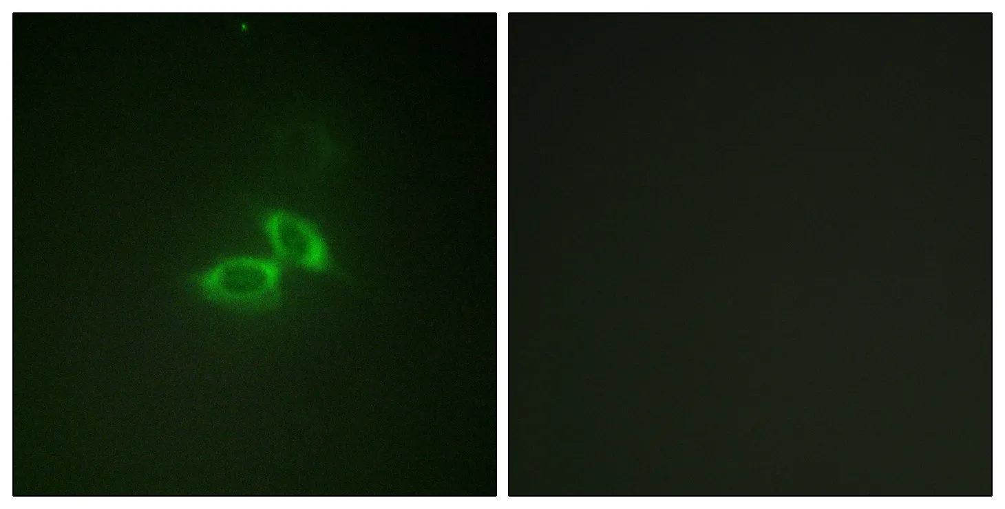 Immunofluorescence analysis of NIH/3T3 cells, using NMDAR1 Antibody. The picture on the right is blocked with the synthesized peptide.