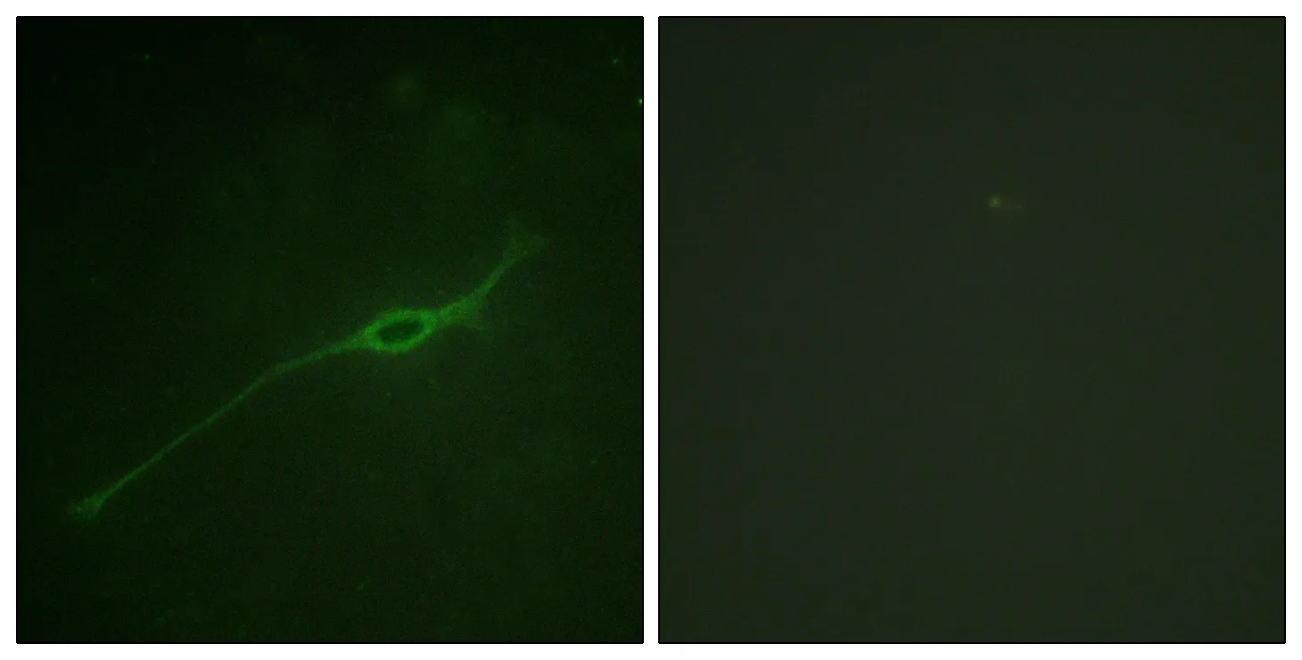 Immunofluorescence analysis of NIH/3T3 cells, using Syntaxin 1A (Phospho-Ser14) Antibody. The picture on the right is blocked with the phospho peptide.