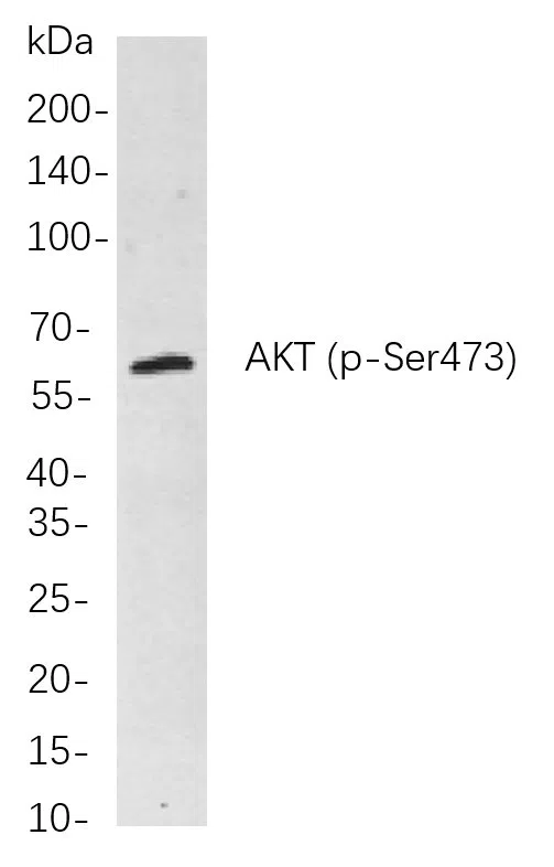 Various whole cell lysates were separated by 4-20% SDS-PAGE, and the primary antibody was used at 4℃, over night with a 1:5000 dilution. The Dylight 800-conjugated Goat anti-Rabbit antibody was used to detect the antibody.