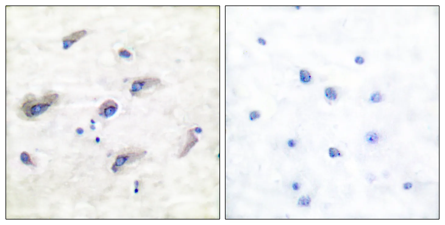 Immunohistochemistry analysis of paraffin-embedded human brain, using Tau (Phospho-Ser356) Antibody. The picture on the right is blocked with the phospho peptide.
