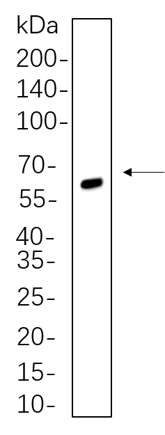 C6 whole cell lysates were separated by 10% SDS-PAGE, and the membrane was blotted with SOX10 Rabbit Monoclonal Antibody(1:1000). The HRP-conjugated Goat anti-Rabbit IgG(H + L) antibody was used to detect the antibody.