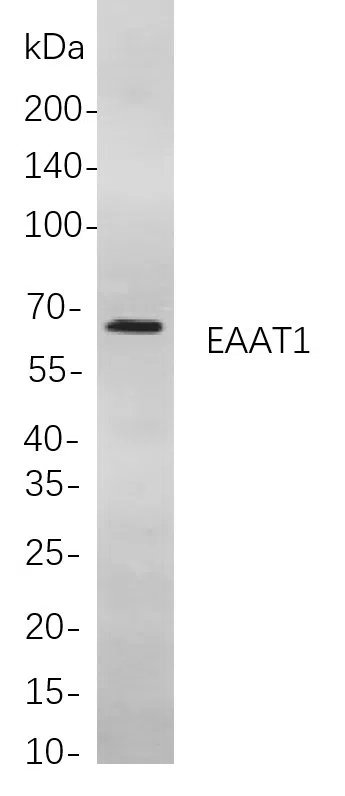 Western blot analysis of lysates from U-87MG cells, using EAAT1 Rabbit mAb. The HRP-conjugated Goat anti-Rabbit IgG antibody was used to detect the antibody.
