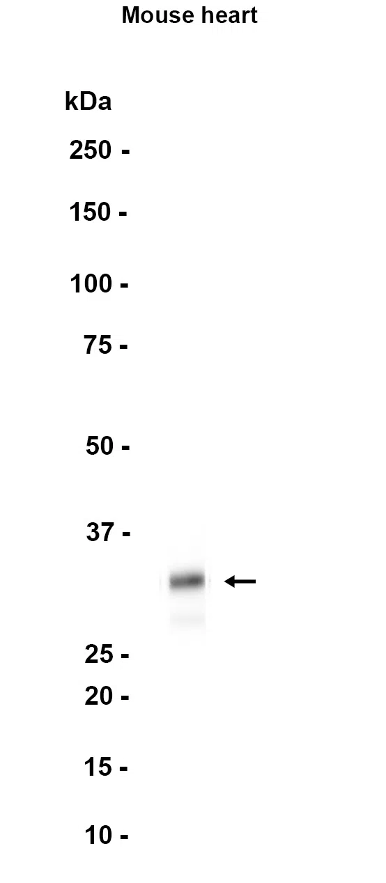 Western blot analysis of extracts from Mouse brain tissue using Syntaxin 1A Rabbit Monoclonal Antibody at 1:1000.