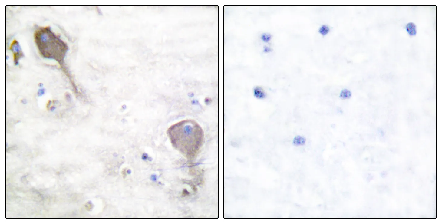 Immunohistochemistry analysis of paraffin-embedded human brain tissue, using Parkin Antibody. The picture on the right is blocked with the synthesized peptide.