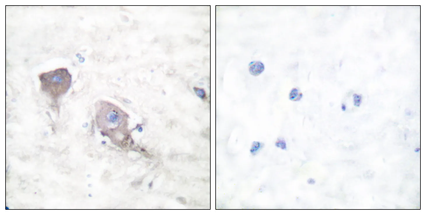 Immunohistochemistry analysis of paraffin-embedded human brain tissue, using SNAP25 Antibody. The picture on the right is blocked with the synthesized peptide.