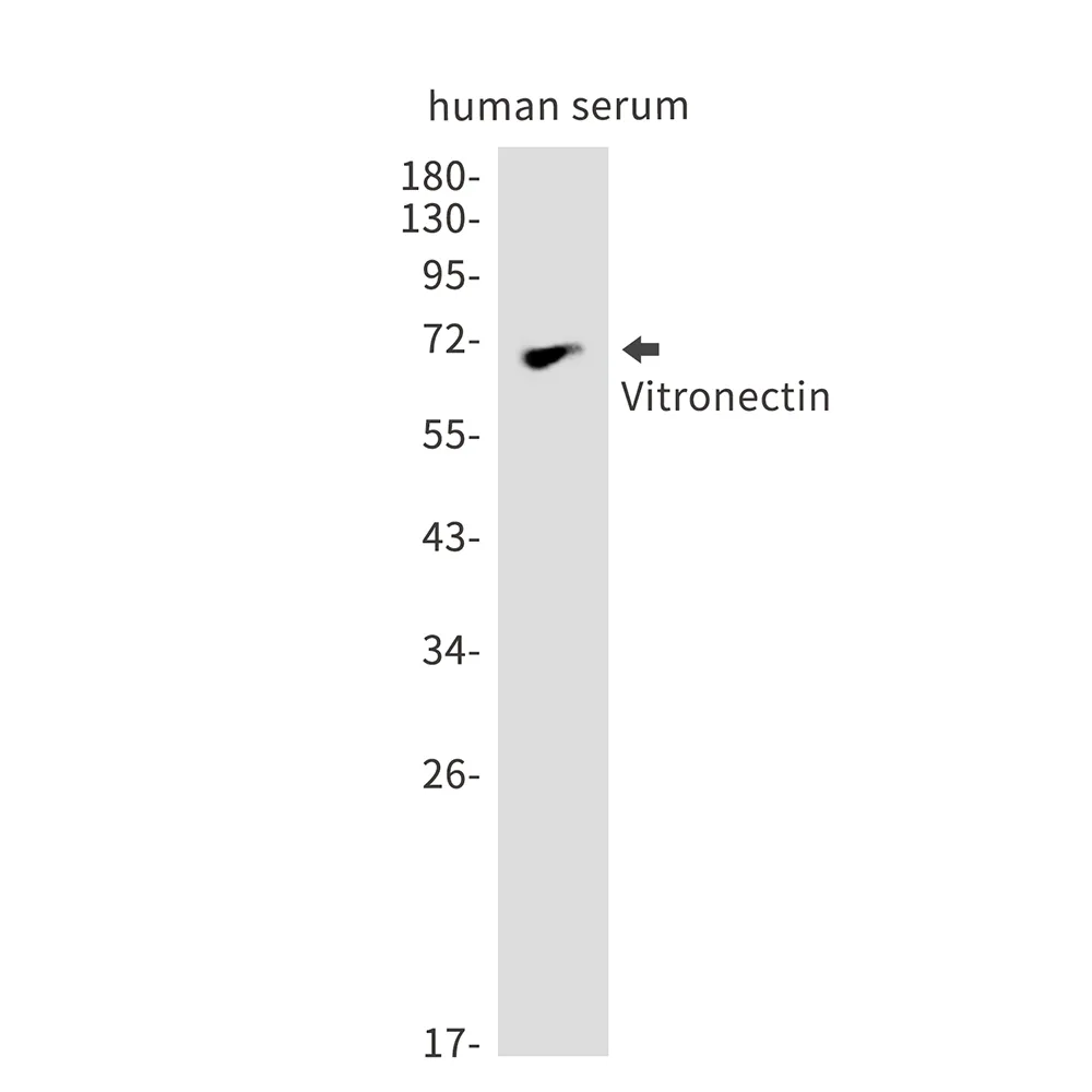 Western blot analysis of Vitronectin in Human serum lysates using Vitronectin antibody.