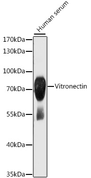Western blot analysis of lysates from human serum, using Vitronectin Rabbit pAb ) at 1:1000 dilution. Secondary antibody: HRP-conjugated Goat anti-Rabbit IgG (H+L) at 1:10000 dilution. Lysates/proteins: 25μg per lane. Blocking buffer: 3% nonfat dry milk in TBST. Detection: ECL Basic Kit.
Exposure time: 1s.
