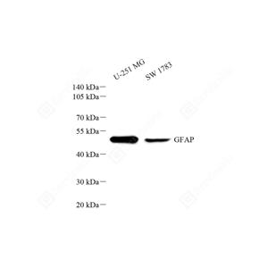 WB analysis of GFAP.Sample: Protein treated by RIPA Lysis Buffer .Blocking buffer: 3% Nonfat dry milk in TBST, RT, 1h.Primary antibody: 1: 1000, 4℃ overnight.Secondary antibody: HRP conjugated Goat Anti-Mouse lgG , 1: 5000, RT, 1h.