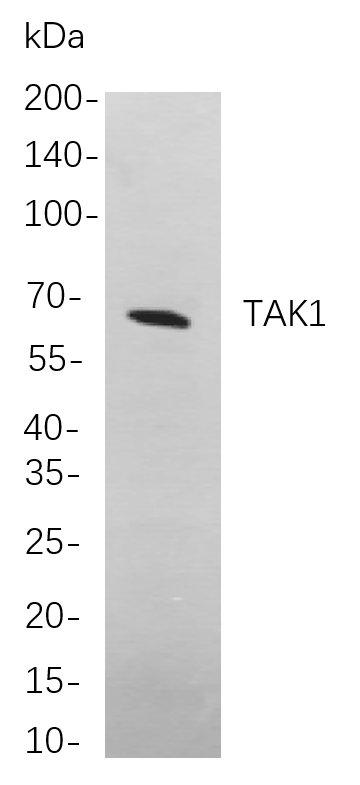 Western blot analysis of lysates from A431 cells, using TAK1 Rabbit mAb. The HRP-conjugated Goat anti-Rabbit IgG antibody was used to detect the antibody.