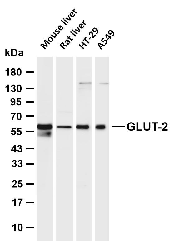 Various whole cell lysates were separated by 4-20% SDS-PAGE, and the membranewasblottedwithanti-GLUT-2antibody.TheHRP-conjugatedGoat anti-Rabbit IgG(H+L) antibody was used to detect the antibody.