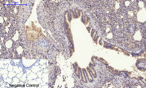 Immunohistochemical analysis of paraffin-embedded Rat-lung tissue. 1,Glut4 Polyclonal Antibody was diluted at 1:200（4°C,overnight）. 2, Sodium citrate pH 6.0 was used for antibody retrieval（>98°C,20min）. 3,Secondary antibody was diluted at 1:200（room tempeRature, 30min）. Negative control was used by secondary antibody only.