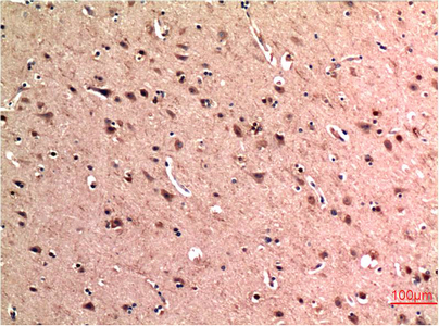 Immunohistochemical analysis of paraffin-embedded Human Brain Tissue using Beclin-1 Mouse mAb diluted at 1:200.