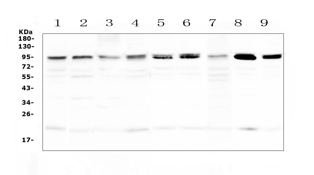 Western blot analysis of PRDM1/Blimp1 using anti-
PRDM1/Blimp1 antibody.  
Electrophoresis was performed on a 5-20% SDS-PAGE gel at 70V
(Stacking gel) / 90V (Resolving gel) for 2-3 hours. The sample well of each lane was loaded with 50ug of sample under reducing conditions.
Lane 1: rat thymus tissue lysates,
Lane 2: rat spleen tissue lysates,
Lane 3: rat stomach tissue lysates,
Lane 4: rat lung tissue lysates,
Lane 5: mouse thymus tissue lysates,
Lane 6: mouse spleen tissue lysates,
Lane 7: mouse stomach tissue lysates,
Lane 8: mouse lung tissue lysates,
Lane 9: mouse HEPA1-6 whole cell lysates.
After Electrophoresis, proteins were transferred to a
Nitrocellulose membrane at 150mA for 50-90 minutes. Blocked
the membrane with 5% Non-fat Milk/ TBS for 1.5 hour at RT.
The membrane was incubated with rabbit anti-PRDM1/Blimp1
antigen affinity purified polyclonal antibody  at 0.5 μg/mL overnight at 4°C, then washed with
TBS-0.1%Tween 3 times with 5 minutes each and probed with a
goat anti-rabbit IgG-HRP secondary antibody at a dilution of
1:10000 for 1.5 hour at RT. The signal is developed using an
Enhanced Chemiluminescent detection (ECL) kit 
with Tanon 5200 system. A specific band was detected
for PRDM1/Blimp1 at approximately 92KD. The expected band
size for PRDM1/Blimp1 is at 92KD.