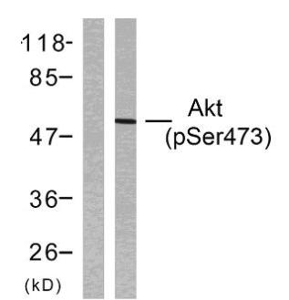 MAB-94125-2