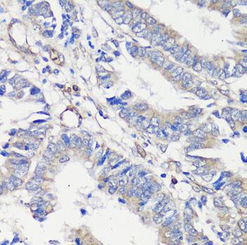 MAB-94636-2.jpg
