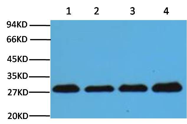 MAB-80035-1