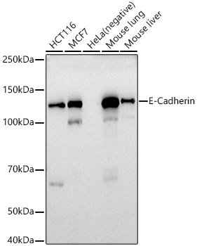 MAB-94755-1