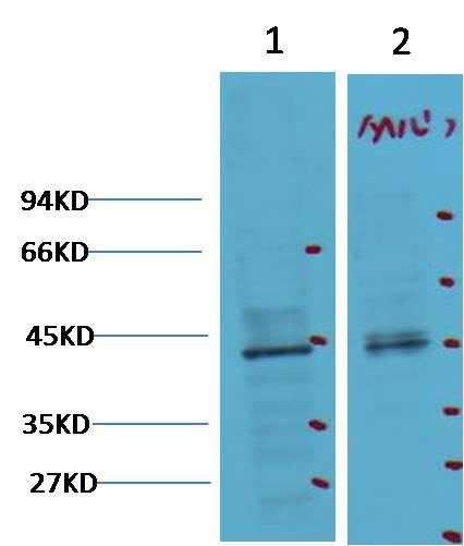 MAB-94764-1