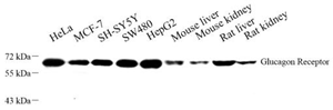 Western blot analysis of Glucagon Receptor at dilution of 1: 500