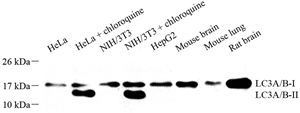 WB analysis of LC3A/B. Sample: Protein treated by RIPA Lysis Buffer . Blocking buffer: 3% Nonfat dry milk in TBST, RT, 1h. Primary antibody: 1: 1000, 4℃ overnight. Secondary antibody: HRP conjugated Goat Anti-Rabbit lgG , 1: 200, RT, 1h.