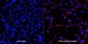 ICC analysis of LC3A/Bred. Sample: C6, methanol 10min. Blocking buffer: 3% BSA in PBS, RT, 30min. Primary antibody: 1: 500, 4℃ overnight. Secondary antibody: Cy3 conjugated Goat Anti-Rabbit IgG , 1: 300, RT, 1h.