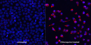 ICC analysis of LC3A/Bred. Sample: HeLa, methanol 10min. Blocking buffer: 3% BSA in PBS, RT, 30min. Primary antibody: 1: 500, 4℃ overnight. Secondary antibody: Cy3 conjugated Goat Anti-Rabbit IgG , 1: 300, RT, 1h.