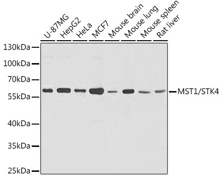 Western blot analysis of various lysates using MST1/STK4 Rabbit pAb at 1:1000 dilution. Secondary antibody: HRP-conjugated Goat anti-Rabbit IgG (H+L) at 1:10000 dilution. Lysates/proteins: 25μg per lane. Blocking buffer: 3% nonfat dry milk in TBST. Detection: ECL West Pico Plus. Exposure time: 15s.