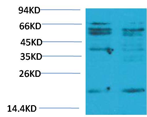 Western blot analysis of LPS Treated HepG2 with TNF α Rabbit pAb diluted at 1:2,000.