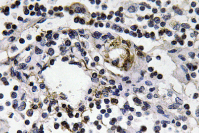Immunohistochemistry analysis of IFN-γ antibody in paraffin-embedded human lymph node tissue.