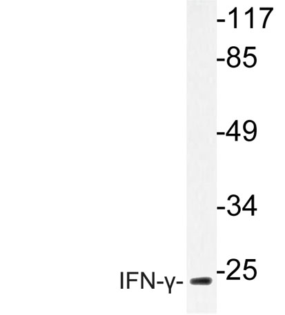 Western blot analysis of lysate from HepG2 cells, using IFN-γ antibody.
