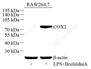 WB analysis of COX2/Cyclooxygenase 2. Sample: Protein treated by RIPA Lysis Buffer . Blocking buffer: 3% Nonfat dry milk in TBST, RT, 1h. Primary antibody: 1: 500, 4℃ overnight. Secondary antibody: HRP conjugated Goat Anti-Rabbit lgG , 1: 3000, RT, 1h.