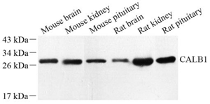 Western blot analysis of Calbindin Ab at dilution of 1: 500