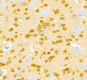 Immunohistochemistry of paraffin embedded mouse brain using Calbindin Ab at dilution of 1: 2000